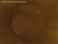 Intestinal Cavity Explorer