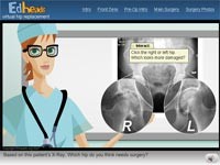 Virtual Hip Surgery: Operazione All’Anca